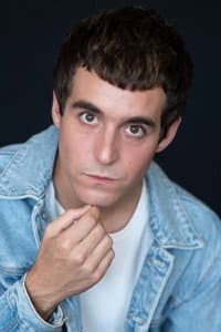 Guillem Barbosa in Alopècia androgènica