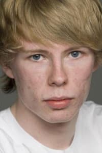 Maarten Stevenson in Blessed