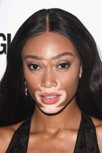 Winnie Harlow in FOMO (Fear of Missing Out)
