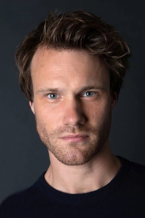 Hugh Skinner foto