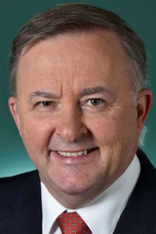Anthony Albanese foto