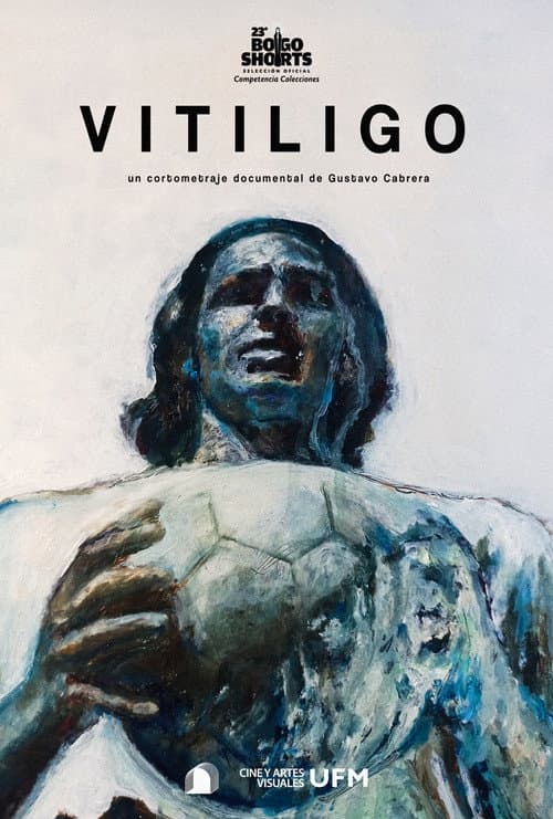 Vitiligo (2025) poster